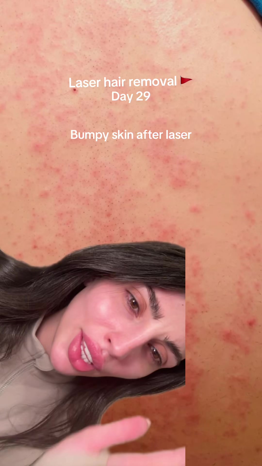 @thelaserladyskincare