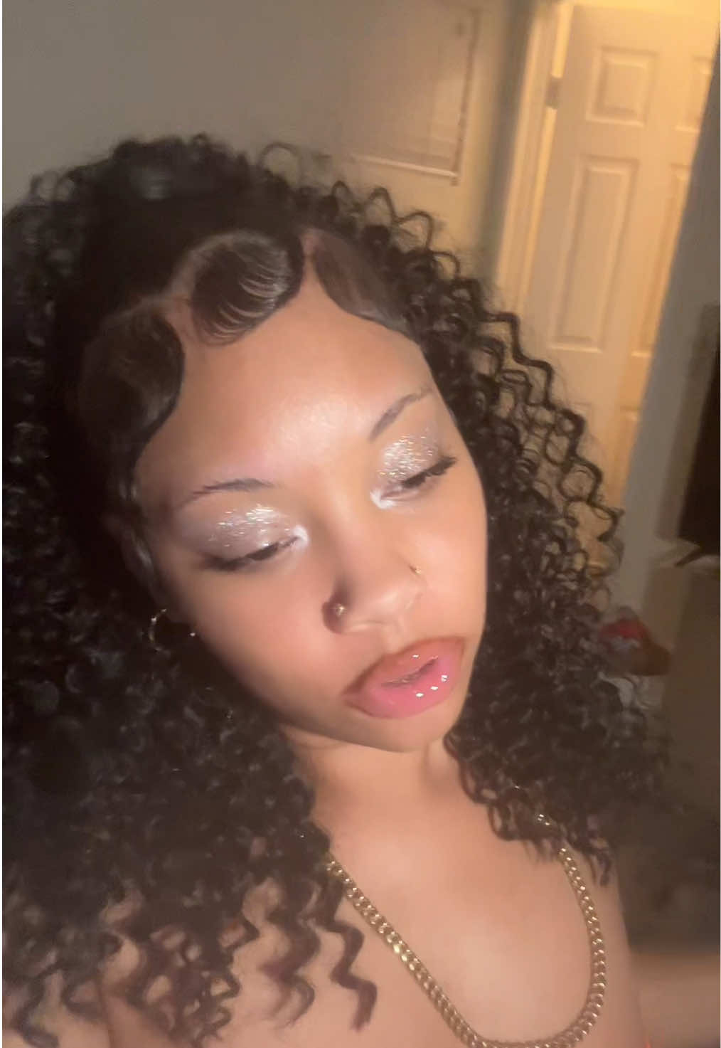 @Redbone