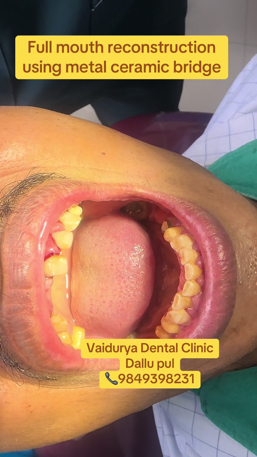 @vaidurya_dental_clinic