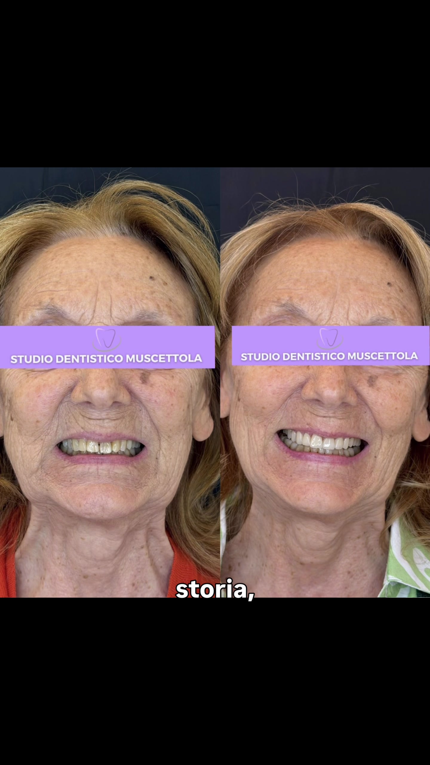 @Dott.Marta | Estetica Dentale