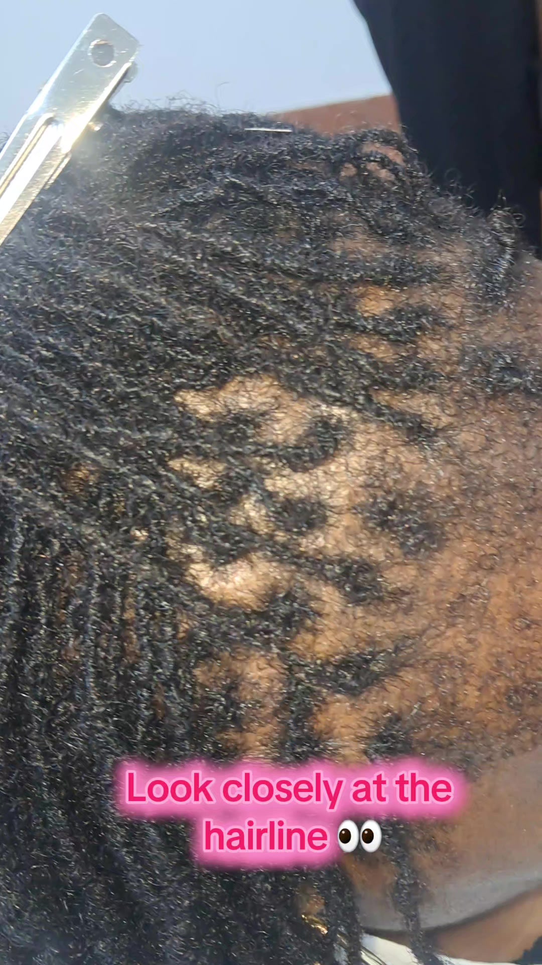 @Kate_Microlocs kenya