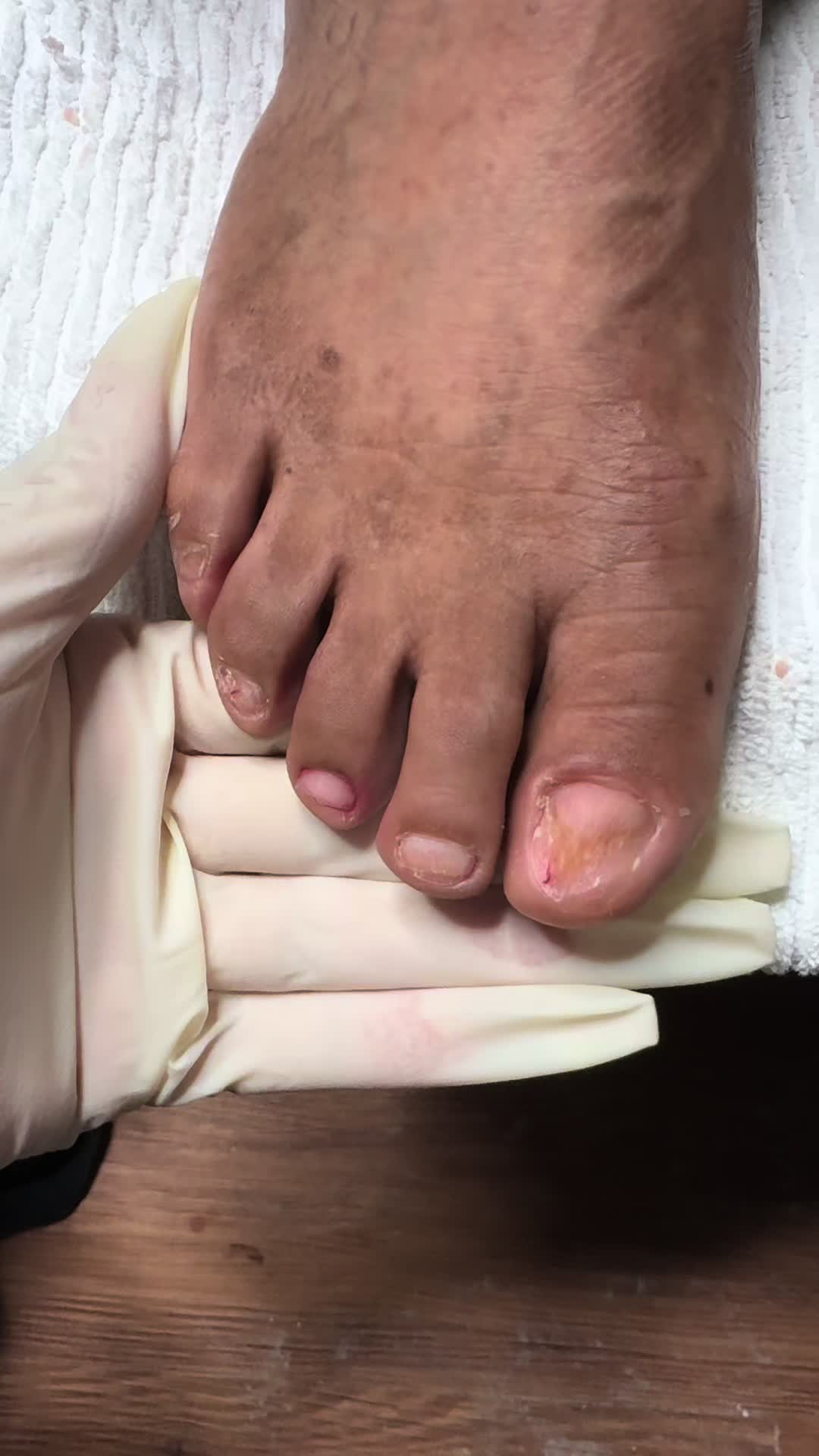 @ToesbyKoki