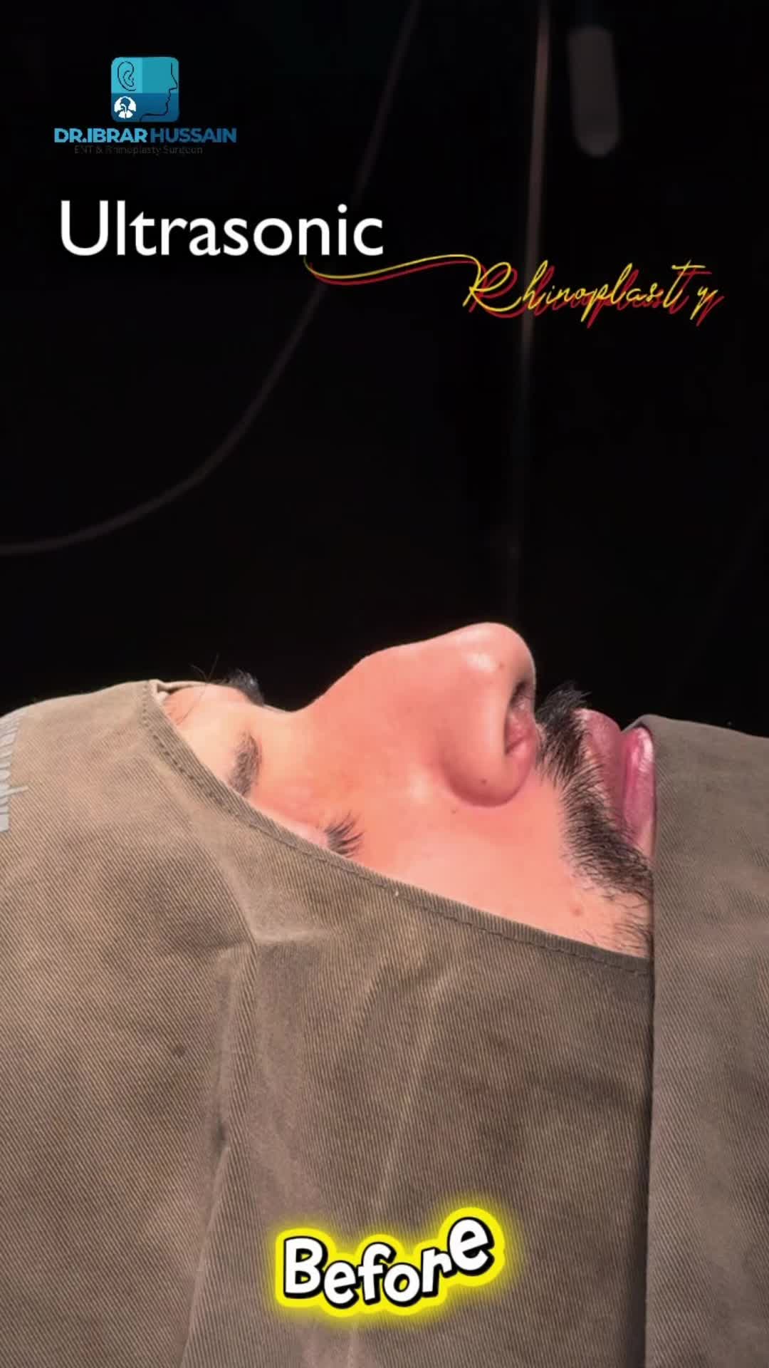 @Dr Ibrar ENT & Rhinoplasty