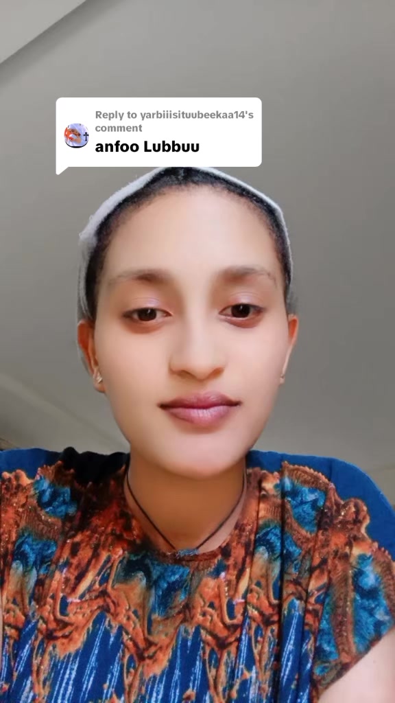 @Bikiltu 21