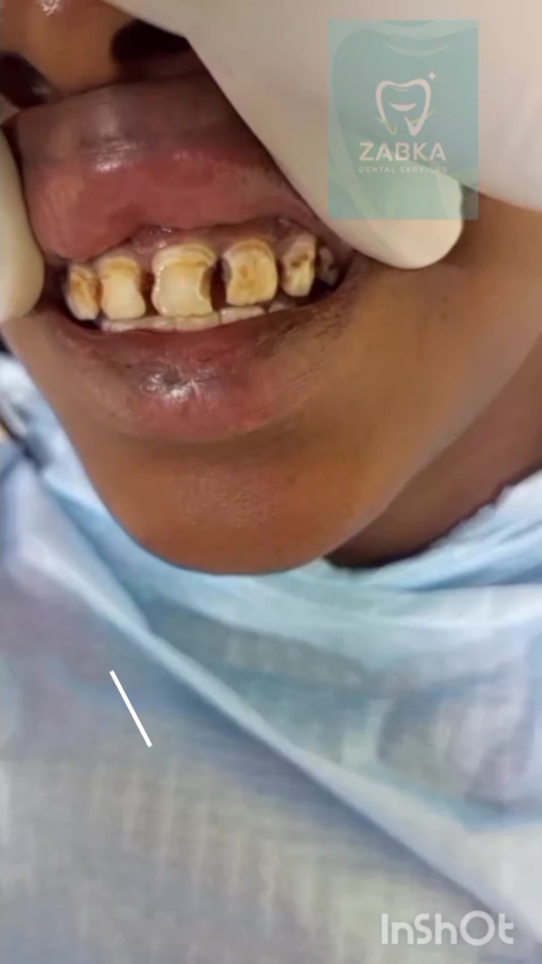 @Zabka Dental