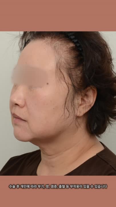 @리프성형외과 김기엽 대표원장