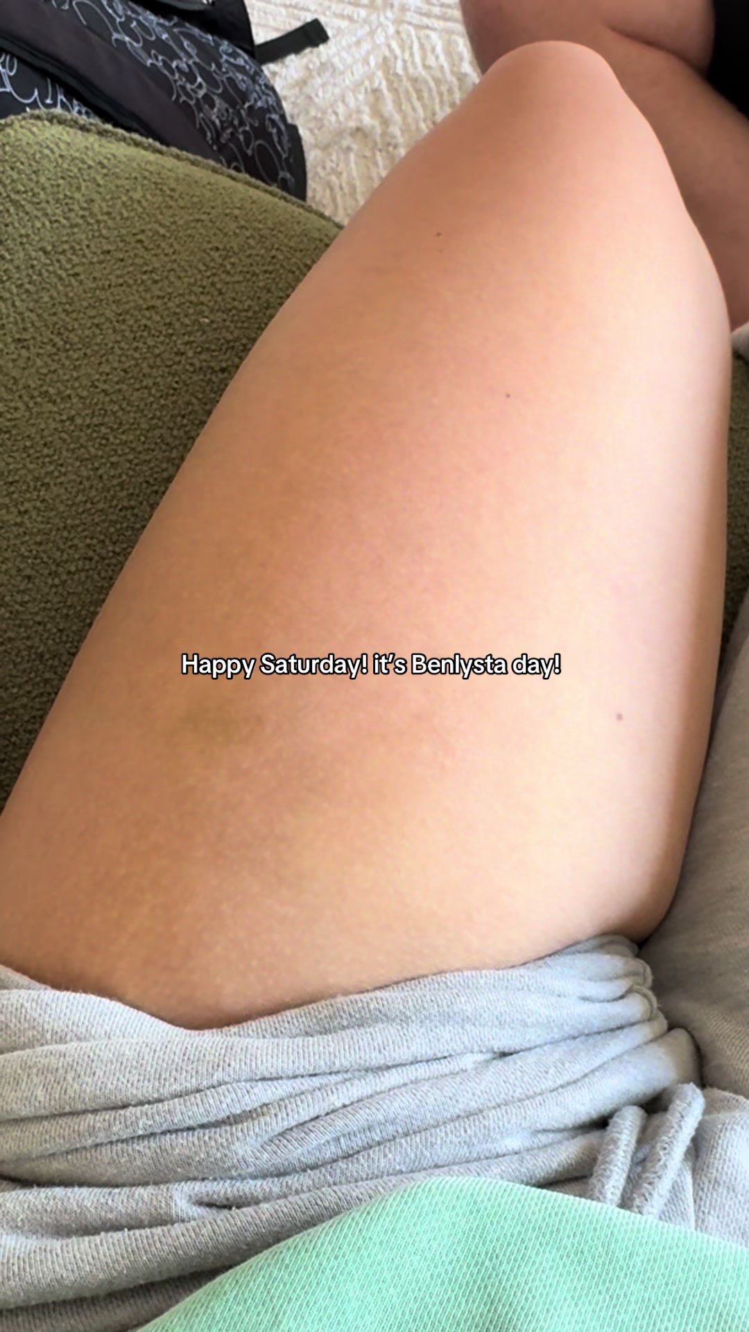 @KK’s lupus journey!