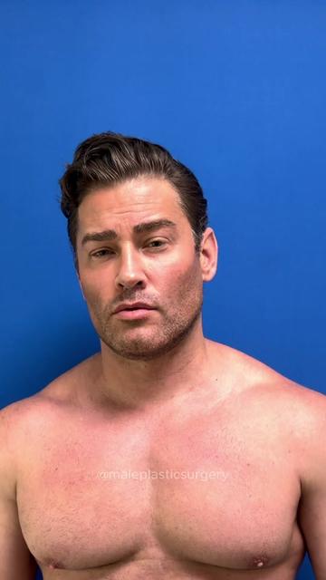 @mensplasticsurgery