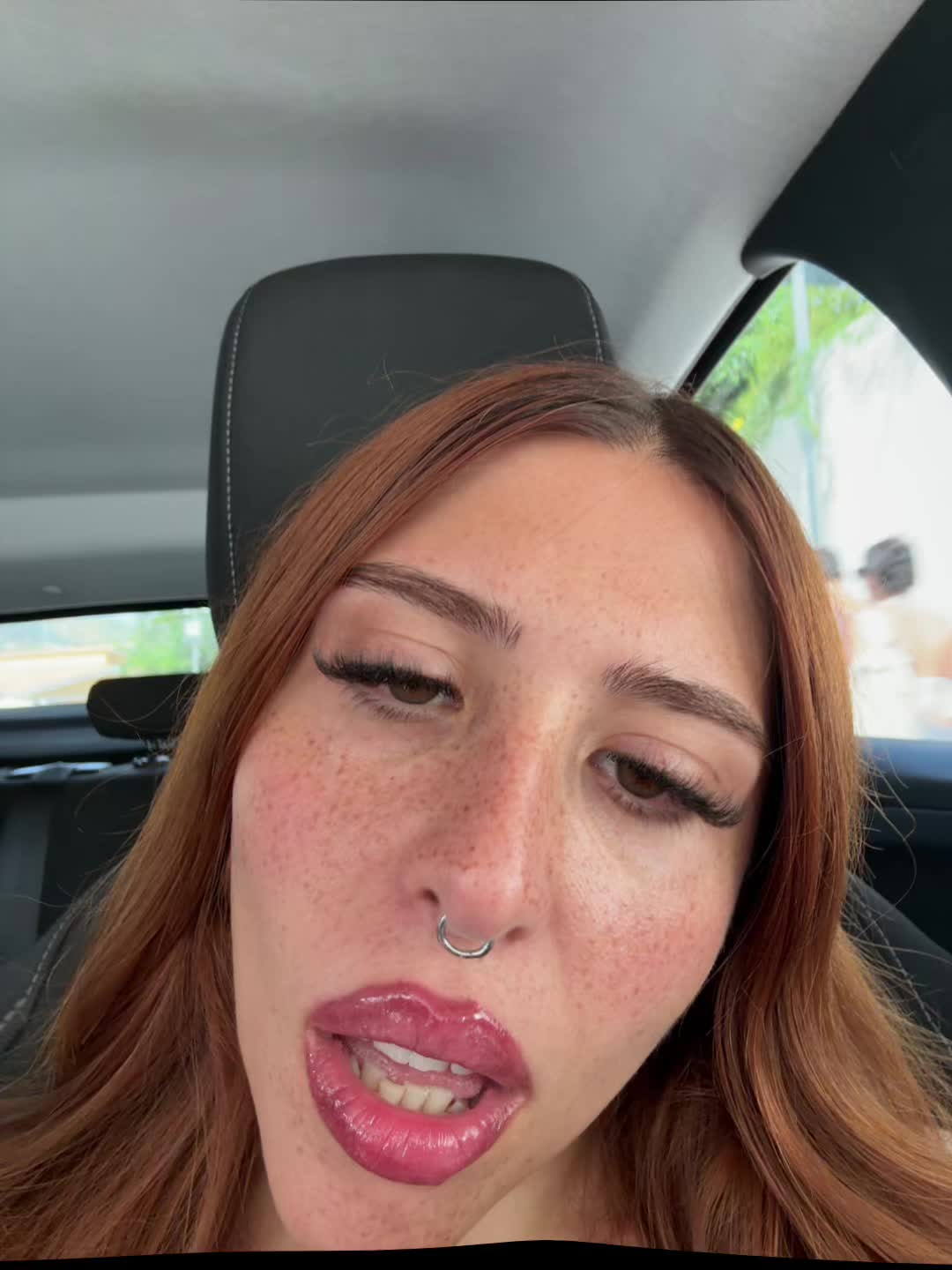 @ketoprophede