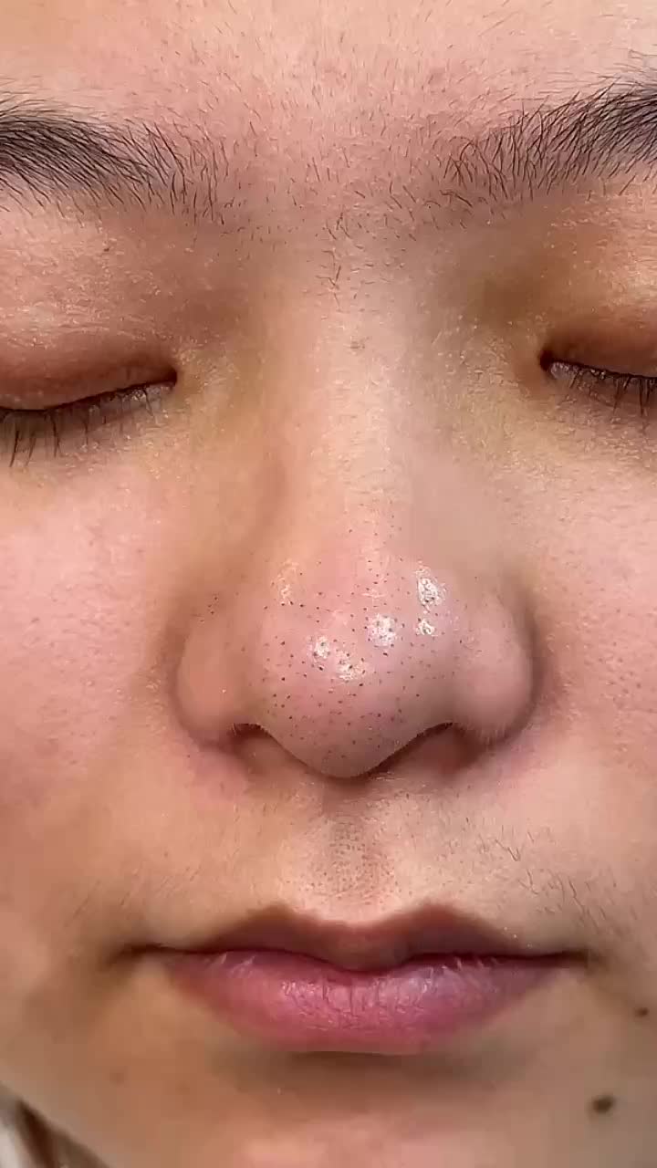 @Skincare Queen👑