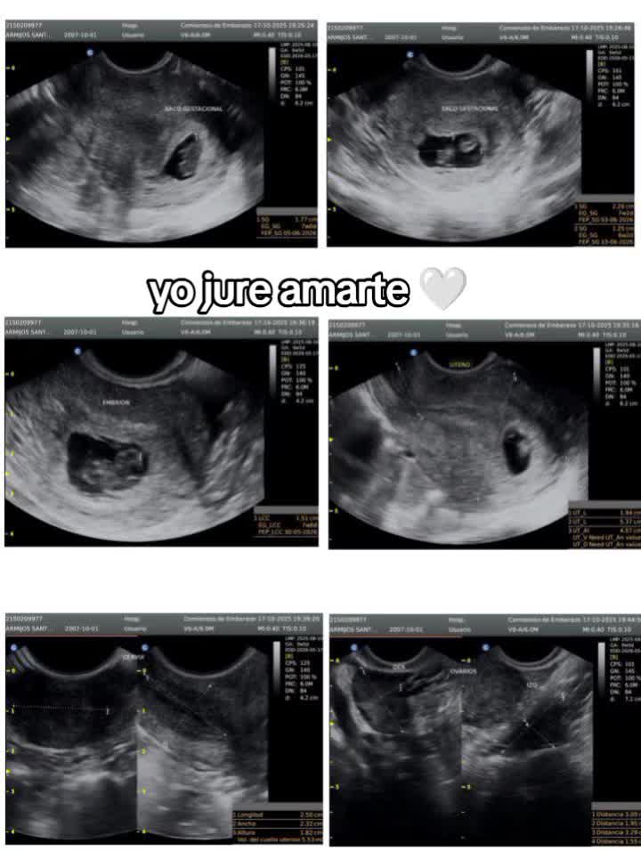 @𝓜𝓲𝓼𝓱𝓮𝓵