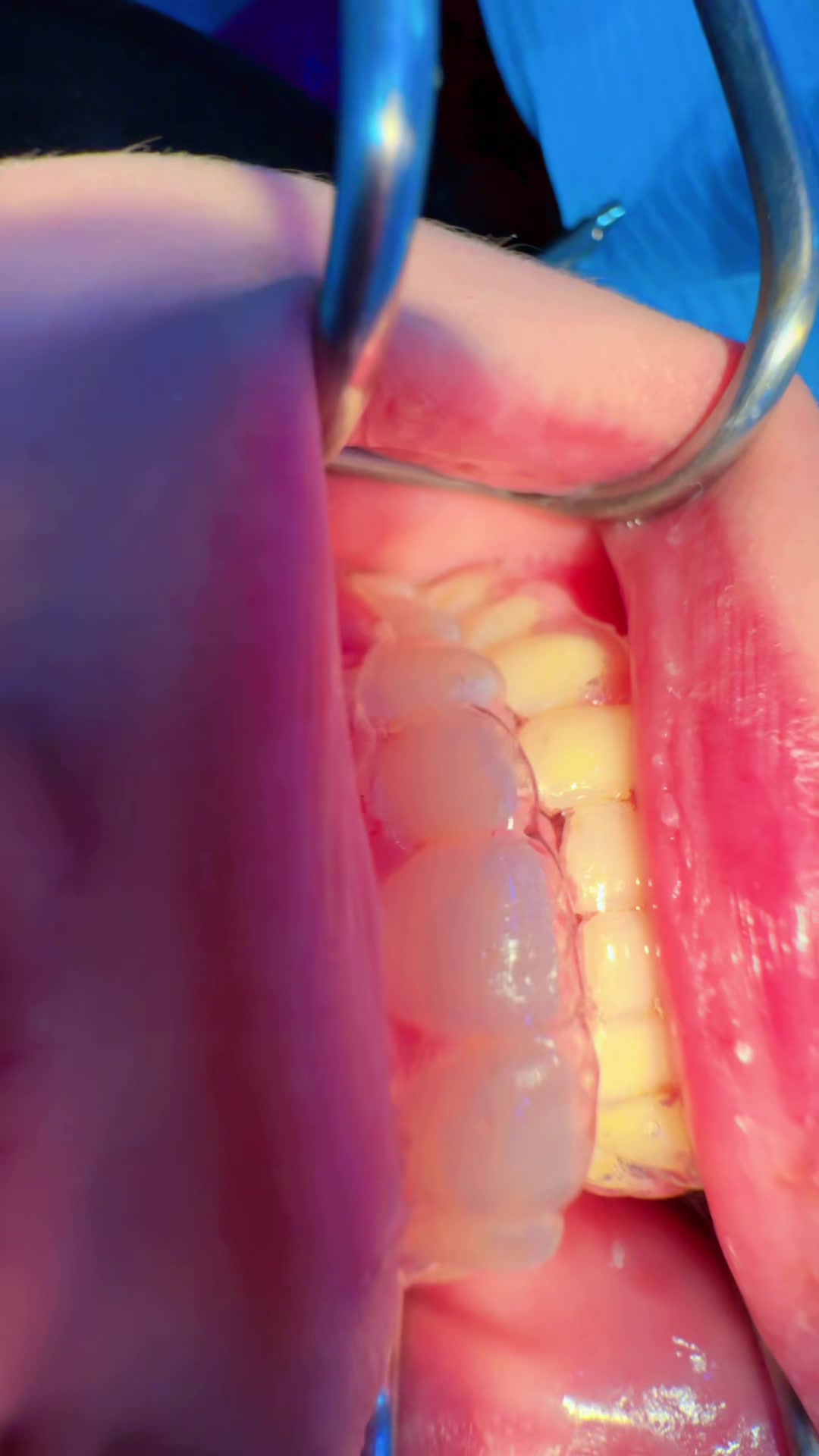 @Dr RahmatullahDental surgeon