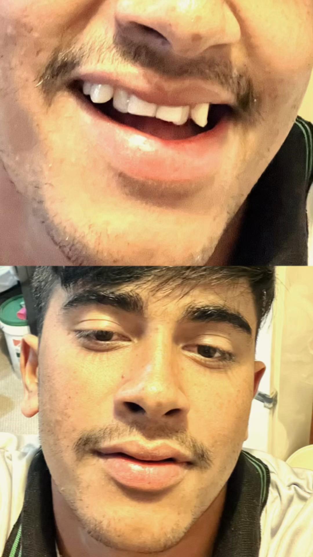 @yadapkhadka41 🇳🇵🇶🇦