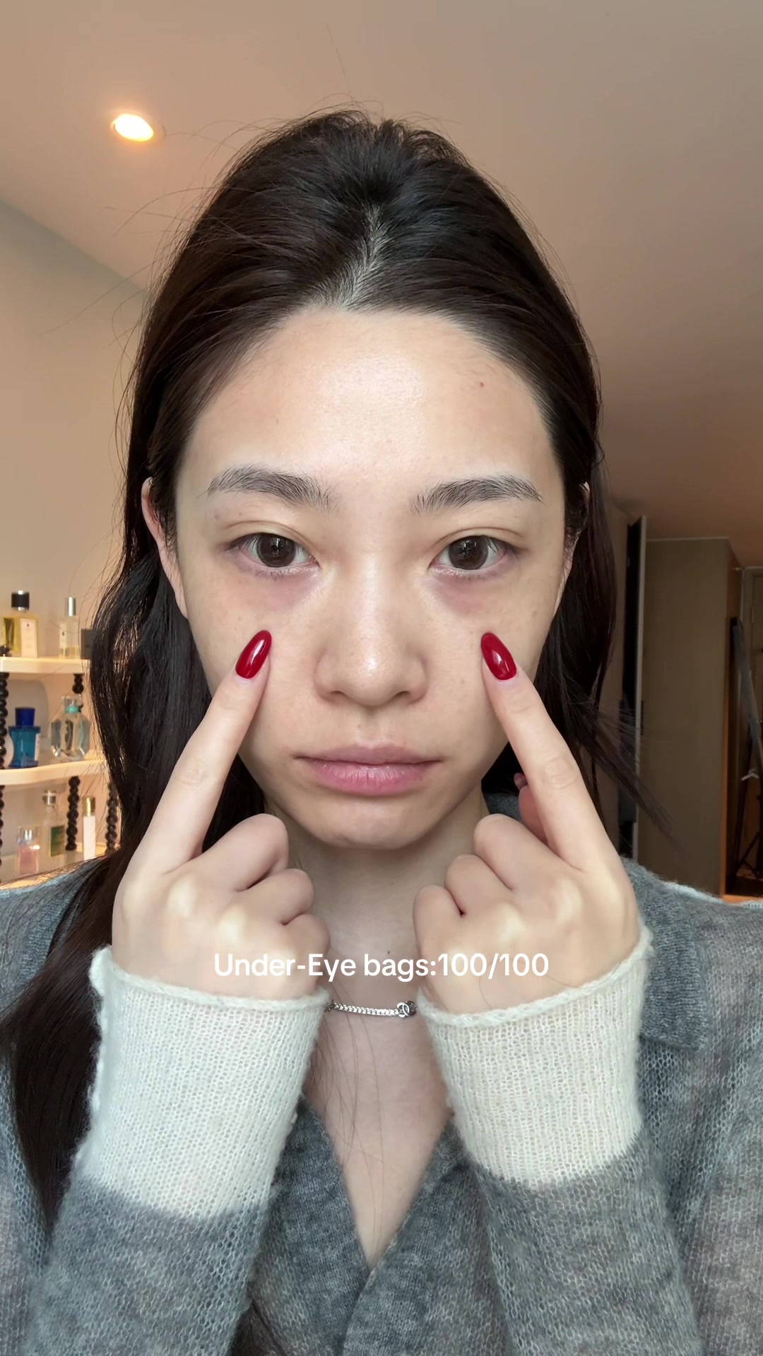 @Yara