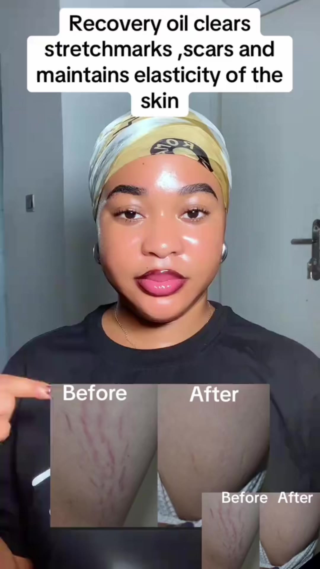 @BEST LIPCARE /SKINCARE BRAND