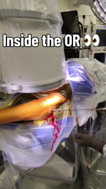 @Ortho POV