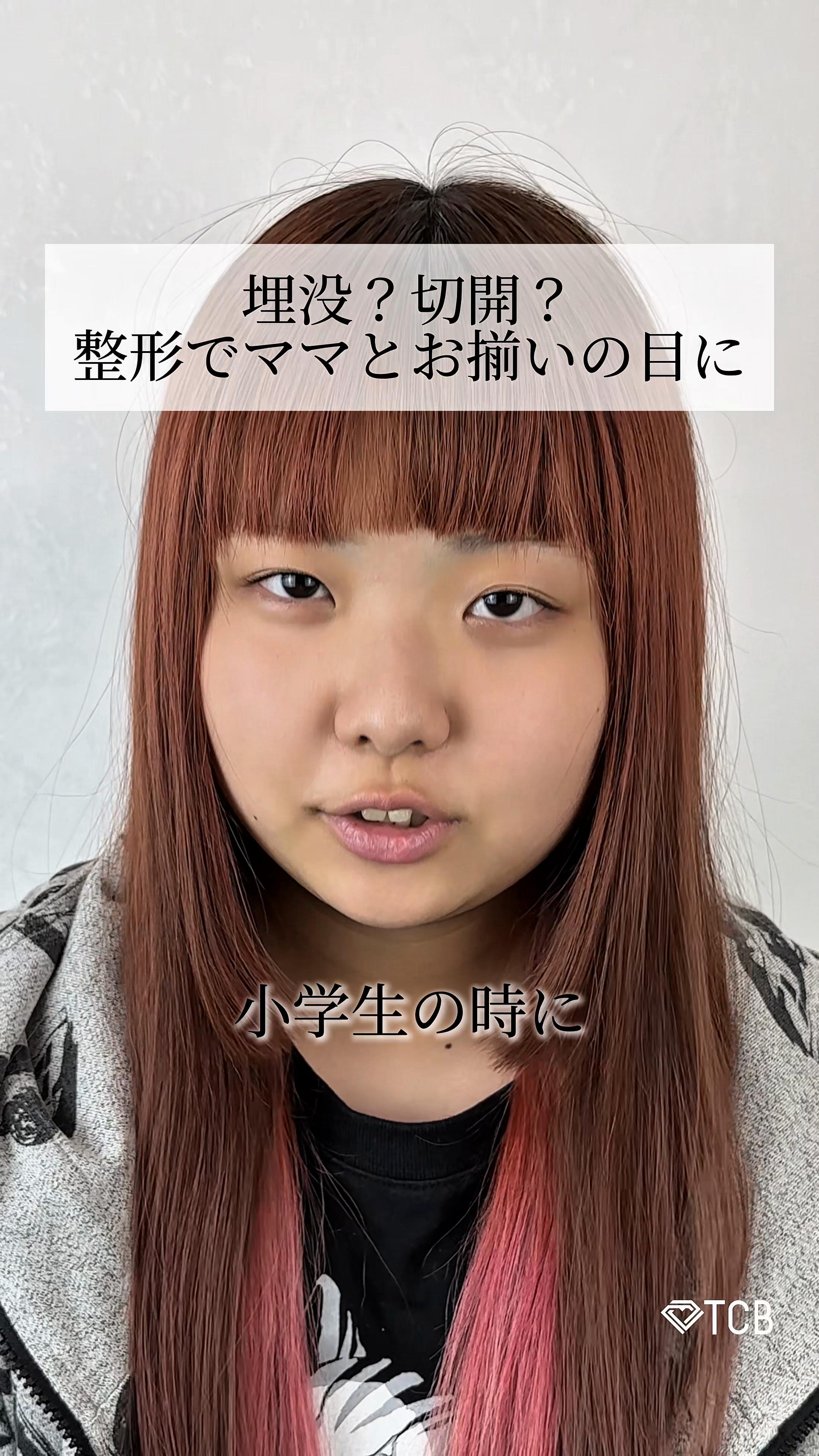 @【二重整形】TCB 新宿東口院ゆいこ先生/東京