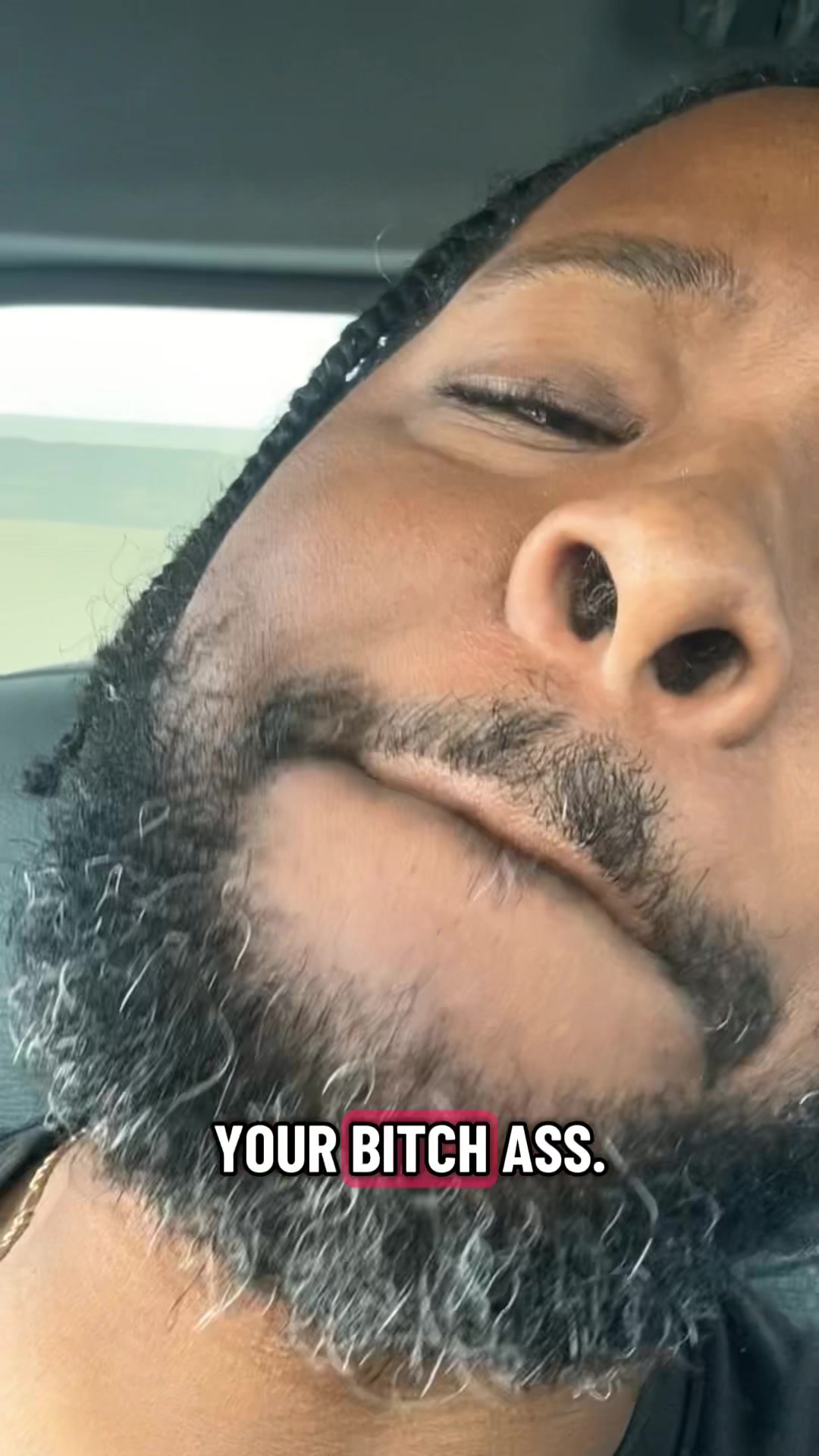 @Skalla Vision