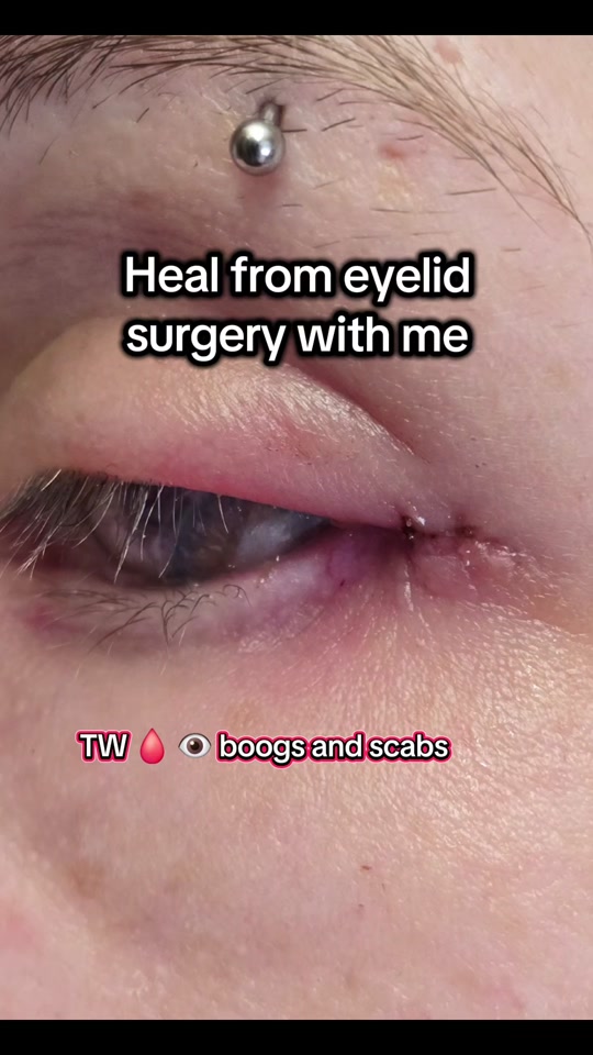 @EyeClops