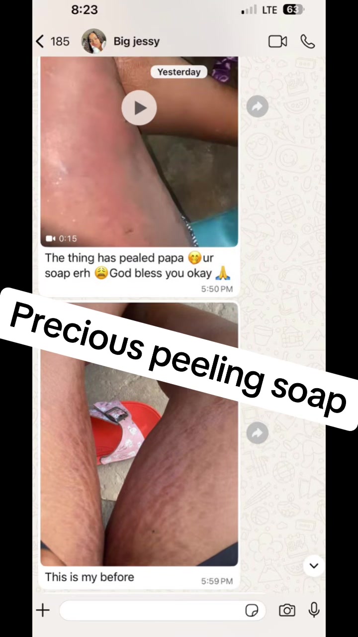 @@ Precious peeling soap