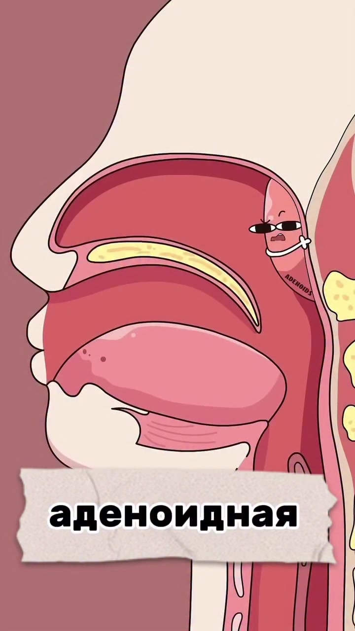 @Dent_tooth