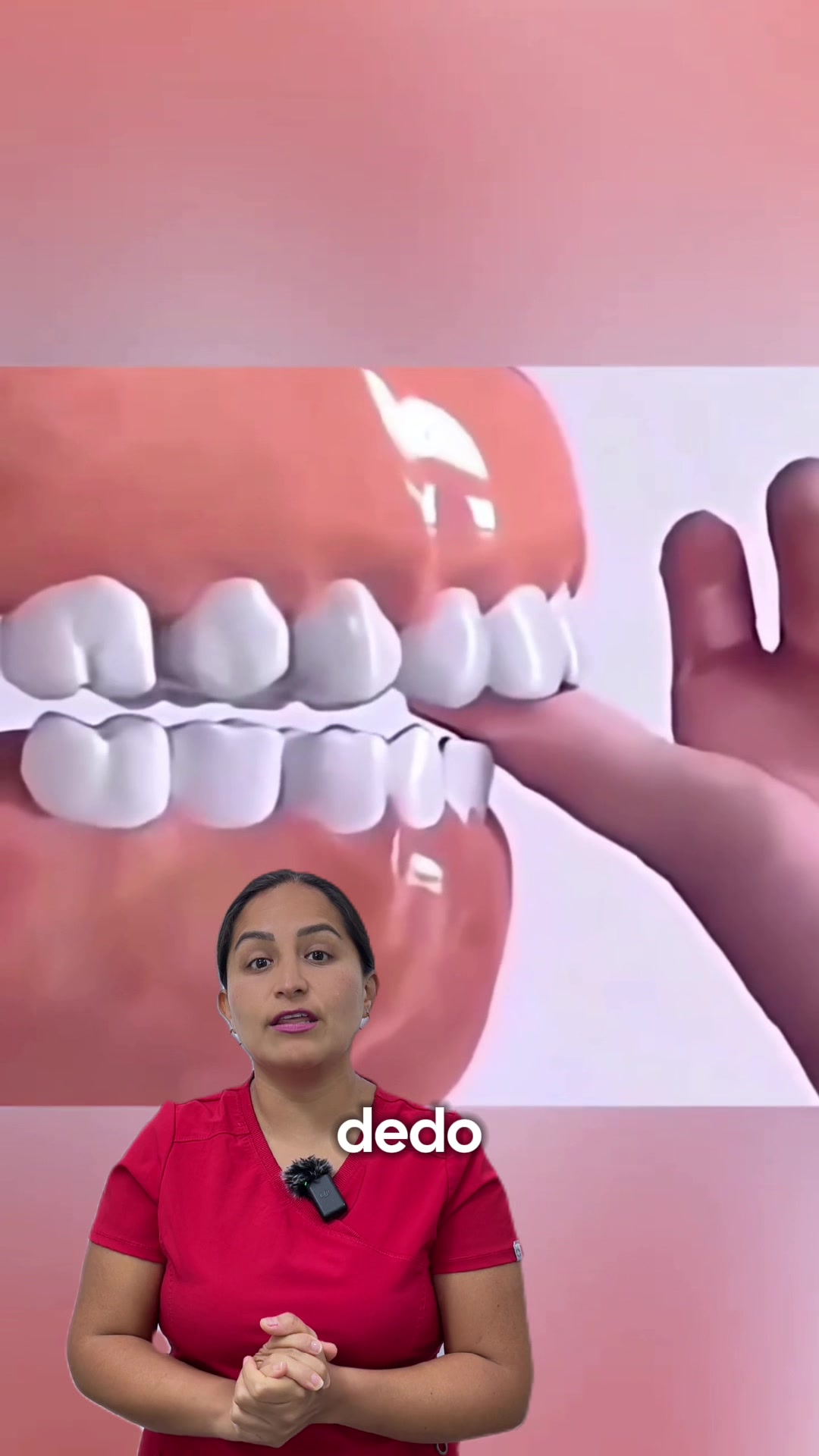 @Brackets y Alineadores