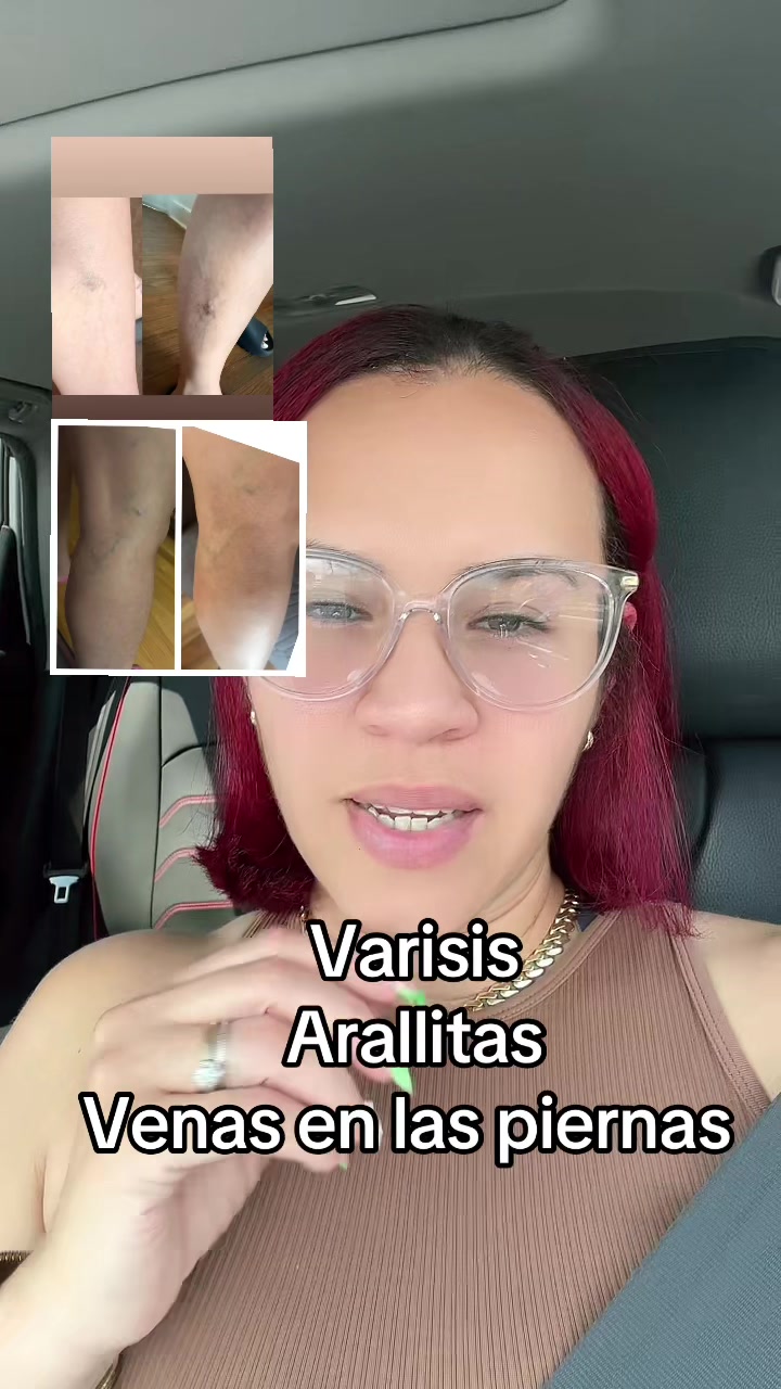 @🦋Candida Lantigua 🦋