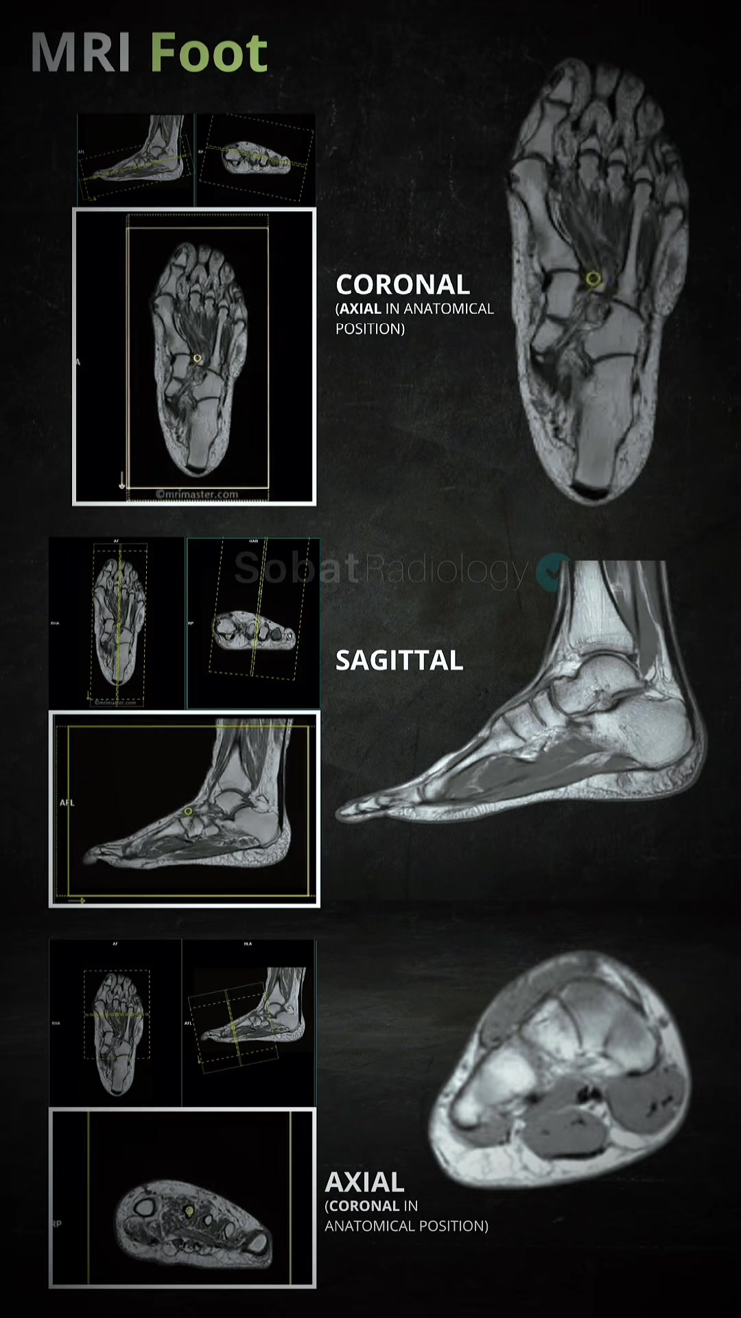 @Sobat Radiology