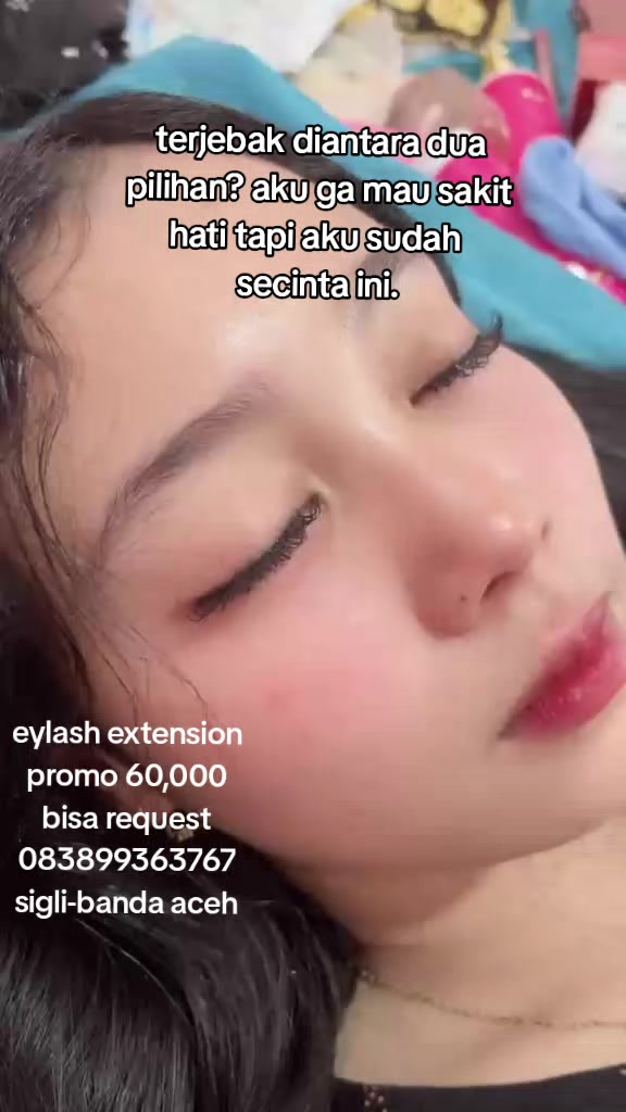 @Eka Eylash dan Behel gigi
