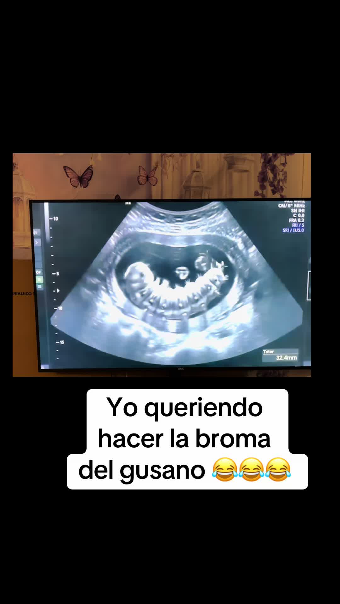 @🇸🇻Guevara Loren 🇸🇻