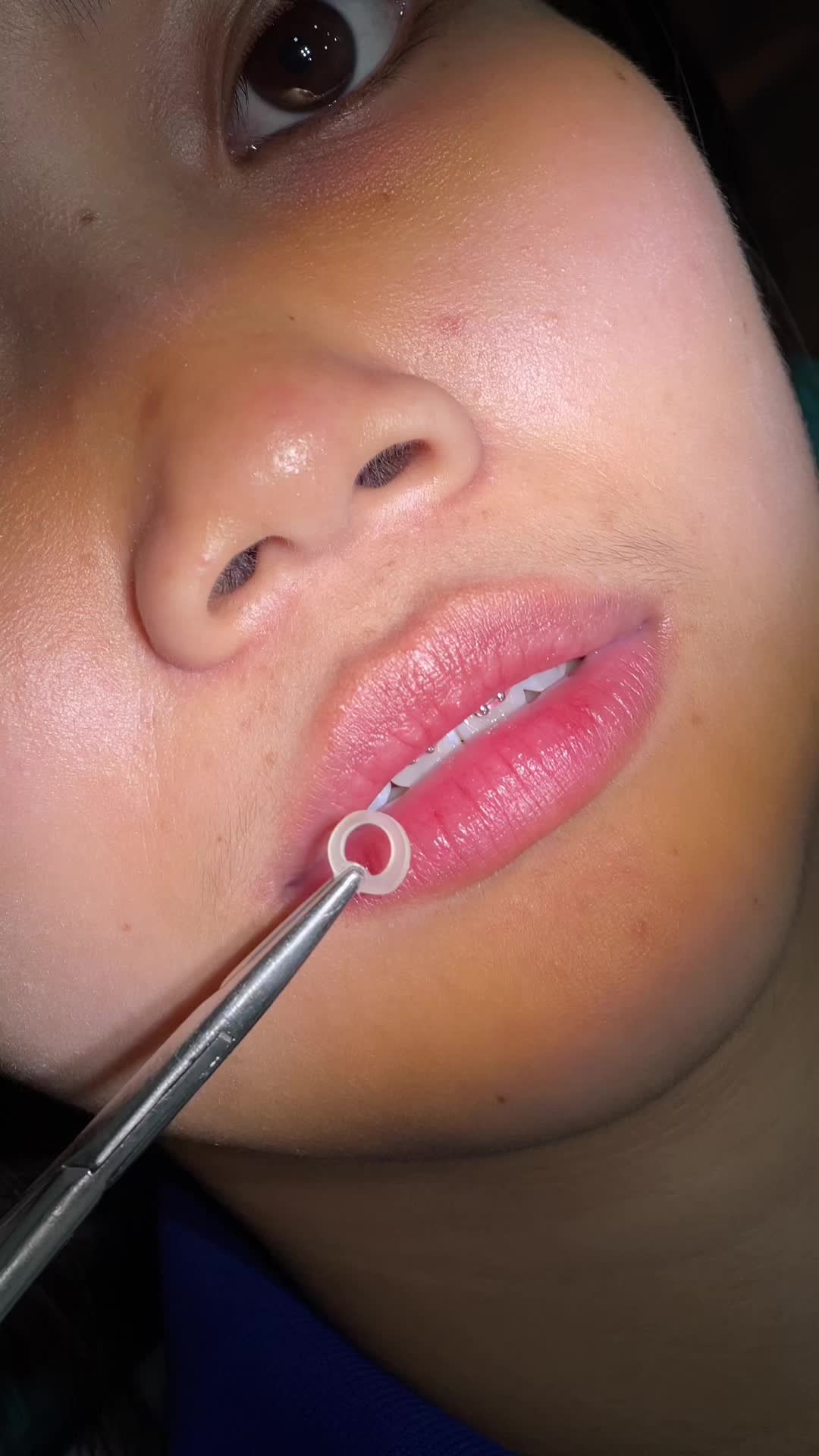 @BRIGHT SMILE DENTAL HOSPITAL