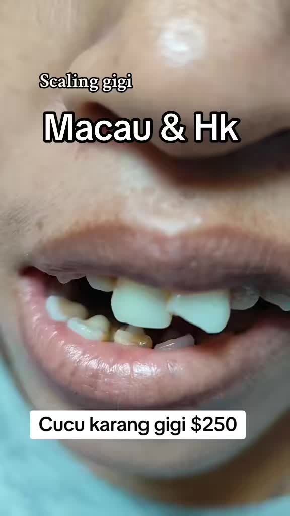 @mbak-Paijem