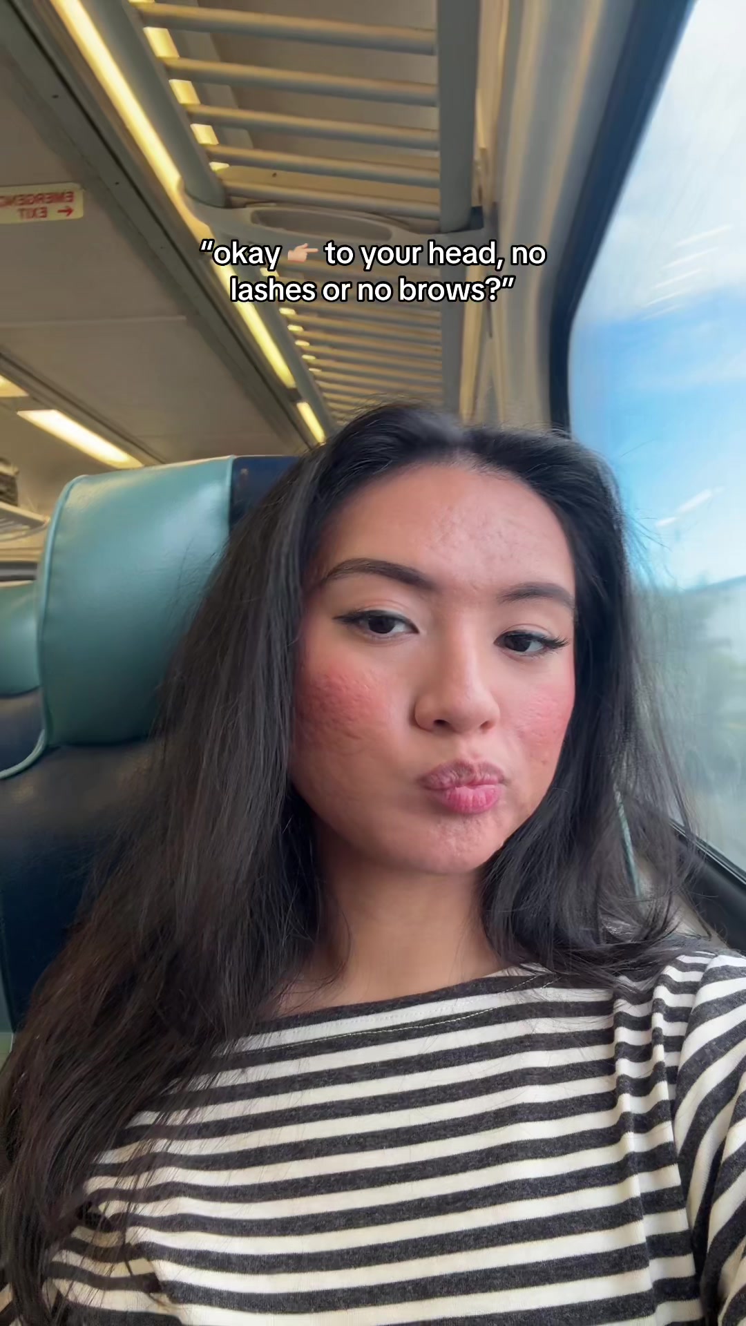 @jennilee • thatacnegirlie