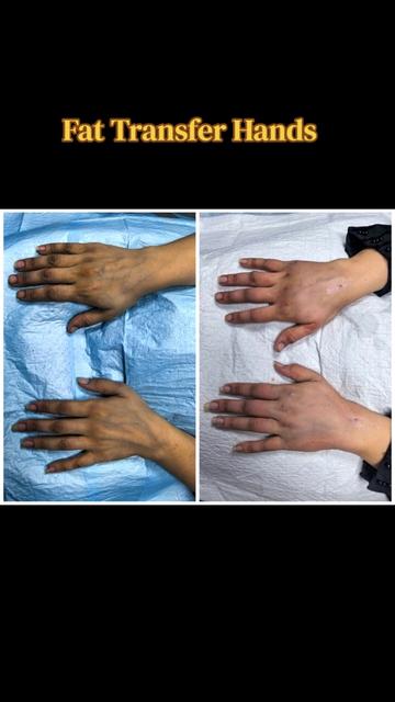 @Dr Firdous Khan PlasticSurgeon