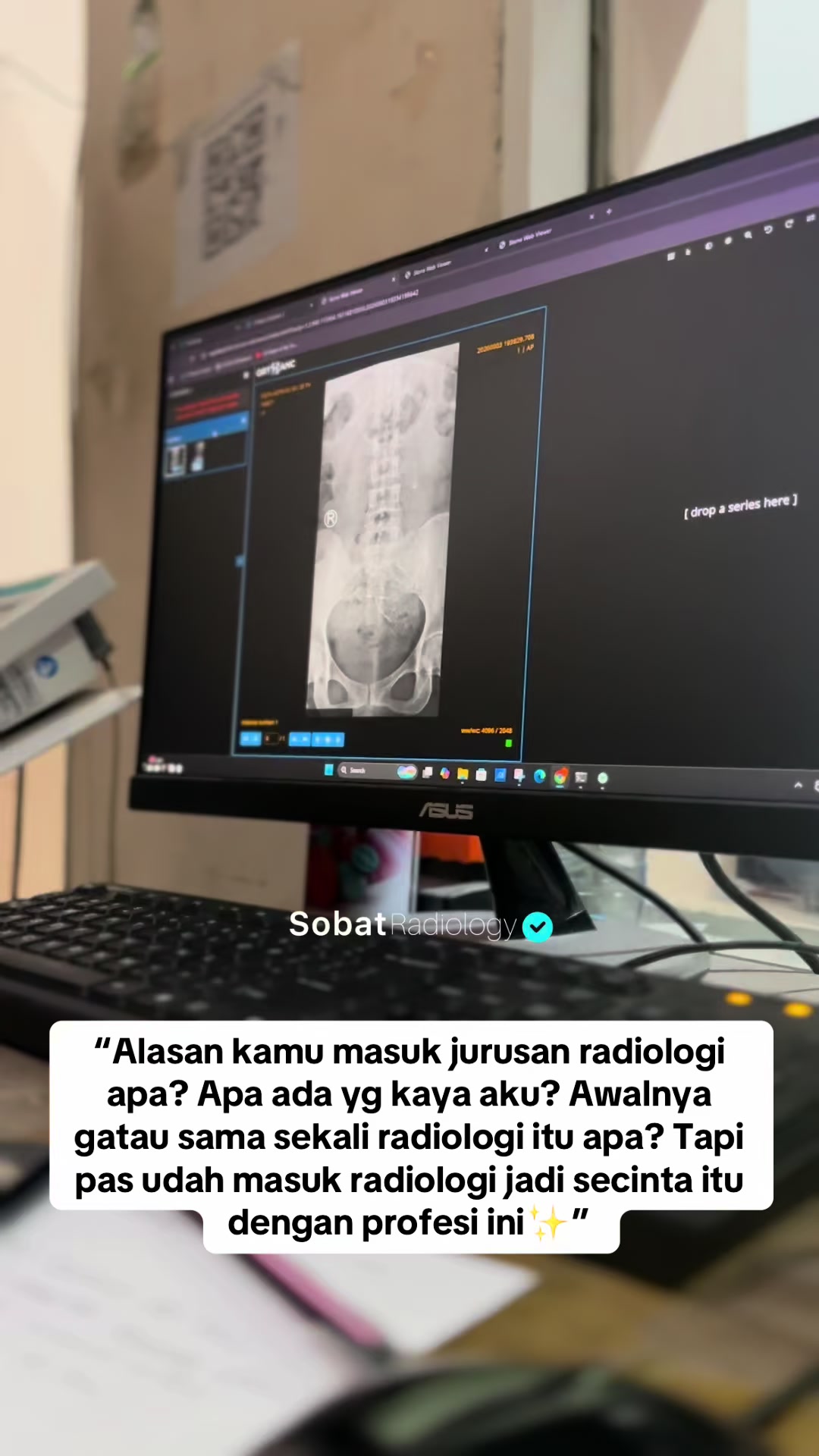 @Sobat Radiology