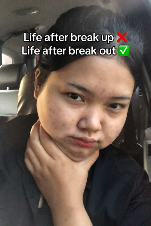 @ichi | glow up journey