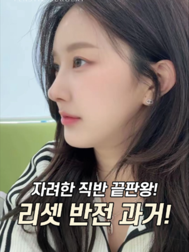 @리셋성형외과