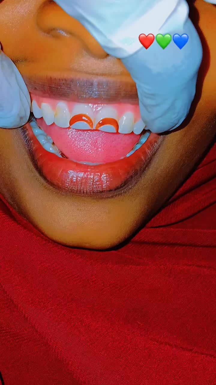 @Dr.Naasir🦷🩵🩺