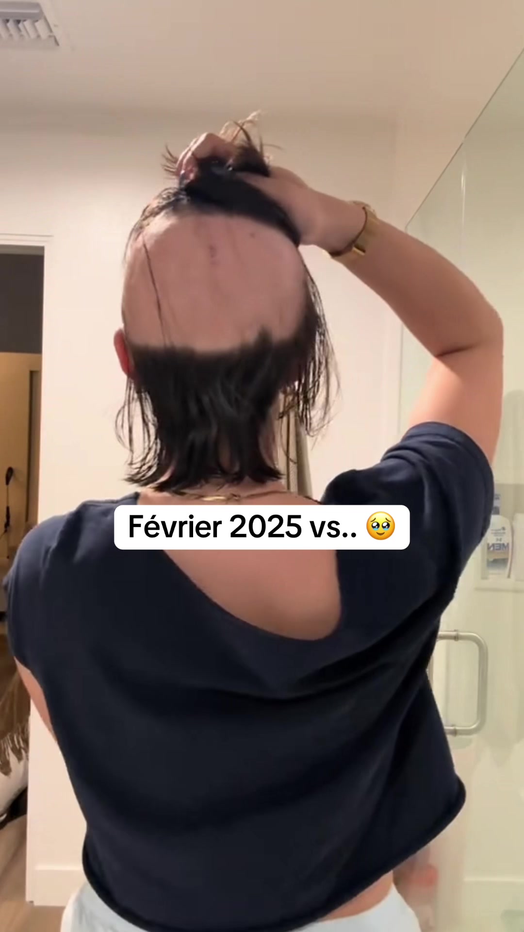 @Lux’Hair Growth FR