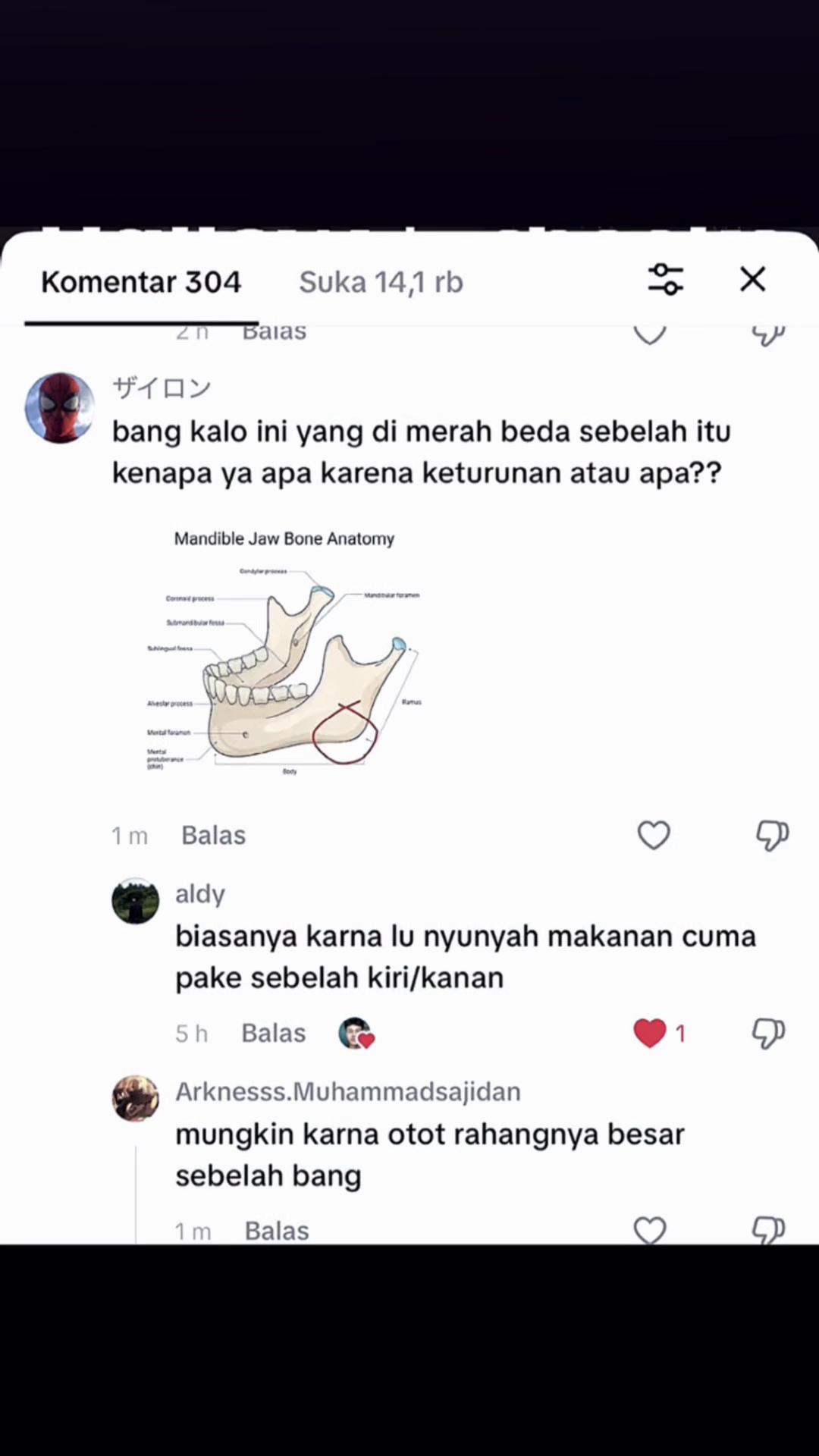 @Gilan
