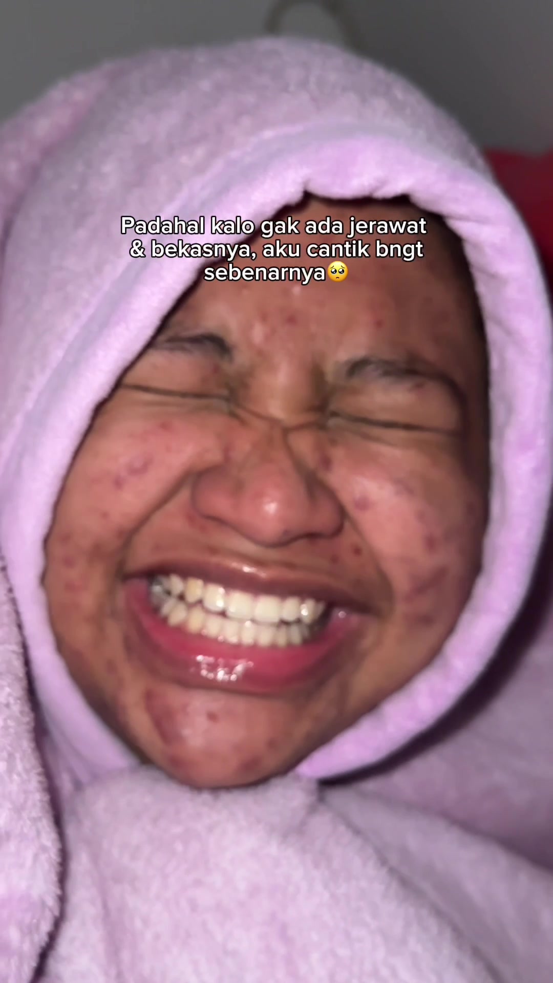 @MBAK CUNGCAT BAYI