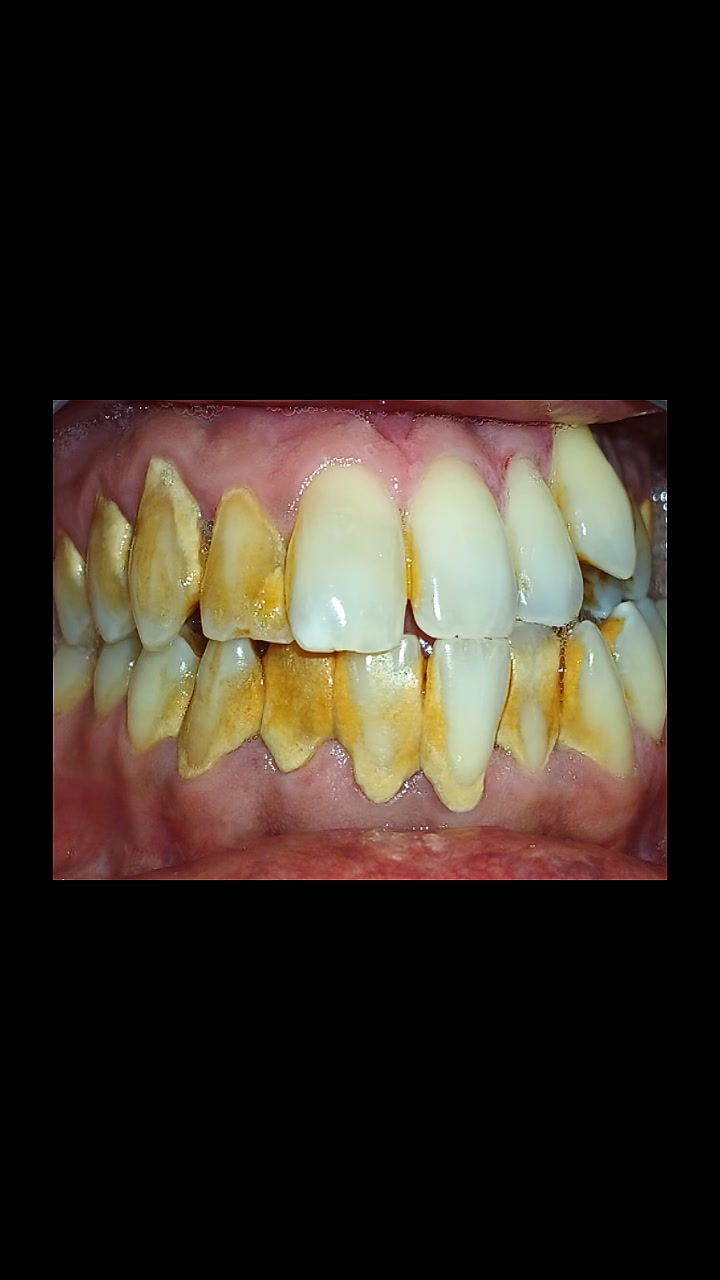 @Dr.Saadat Ali Khan