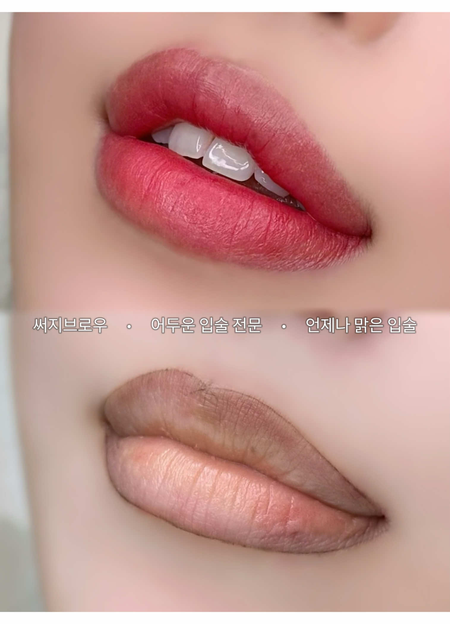 @써지브로우 surgebrow