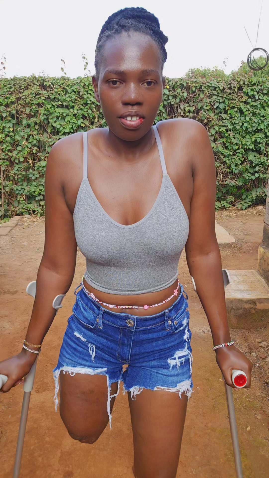 @💎Nattie Amputee🇰🇪♊️