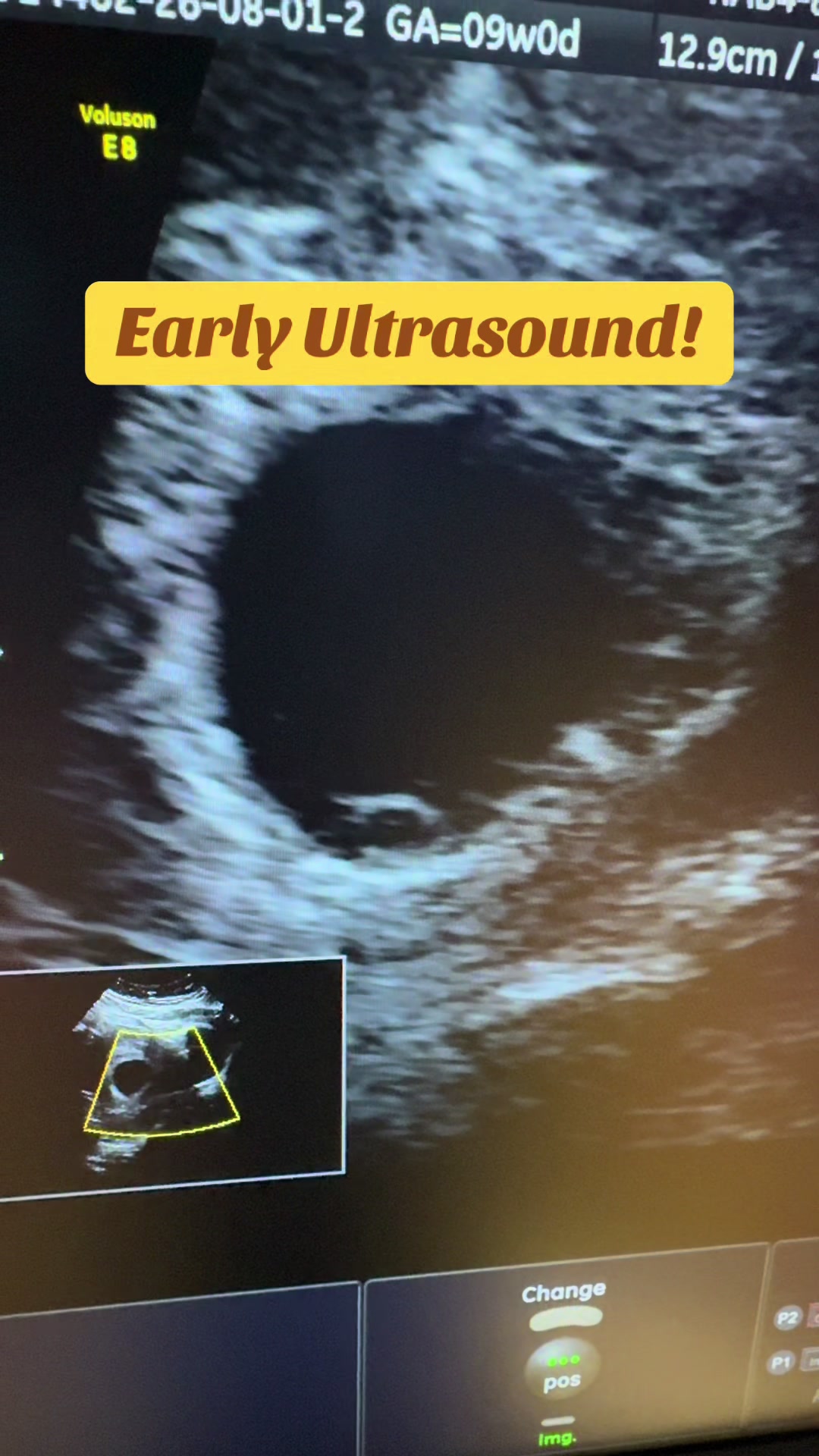 @PregnantSee Inc.