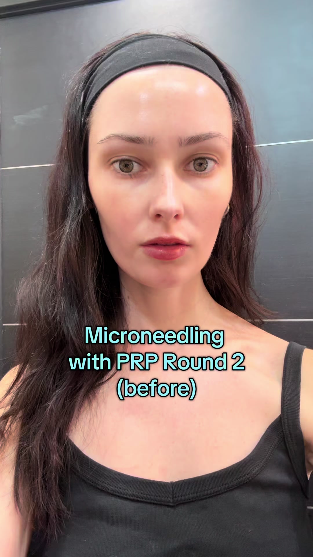 @Porcelainpixie