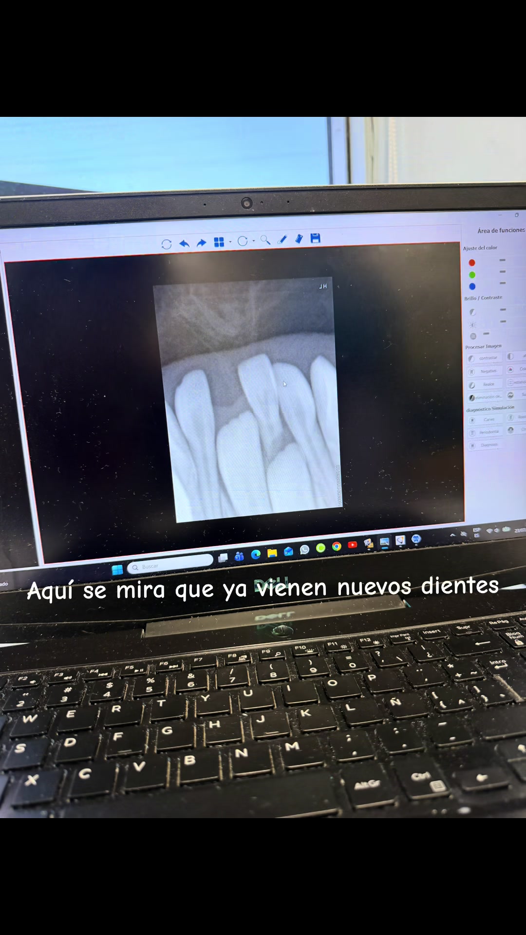 @Anahi Audelo