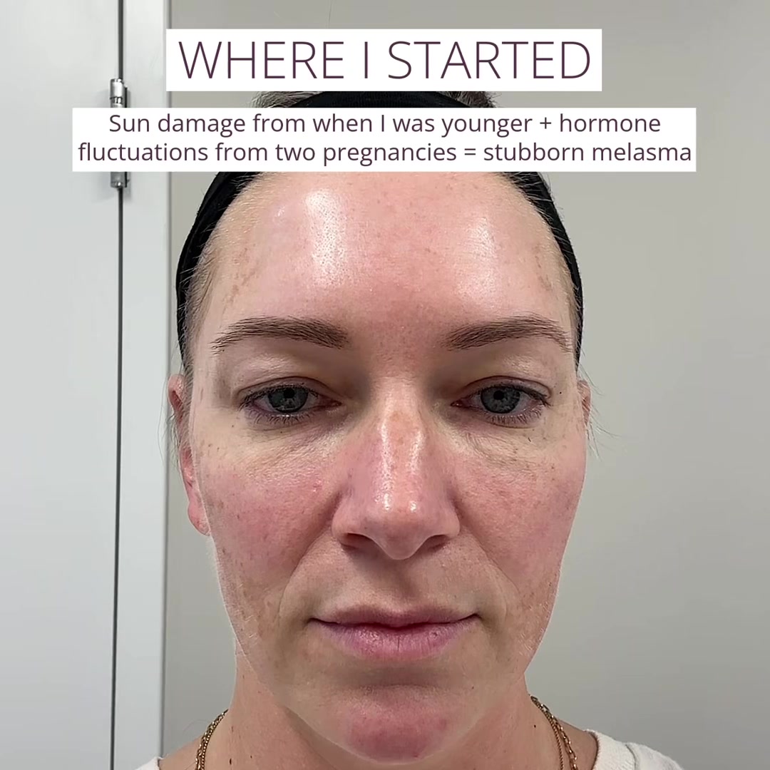 @Mona Dermatology | Cincinnati