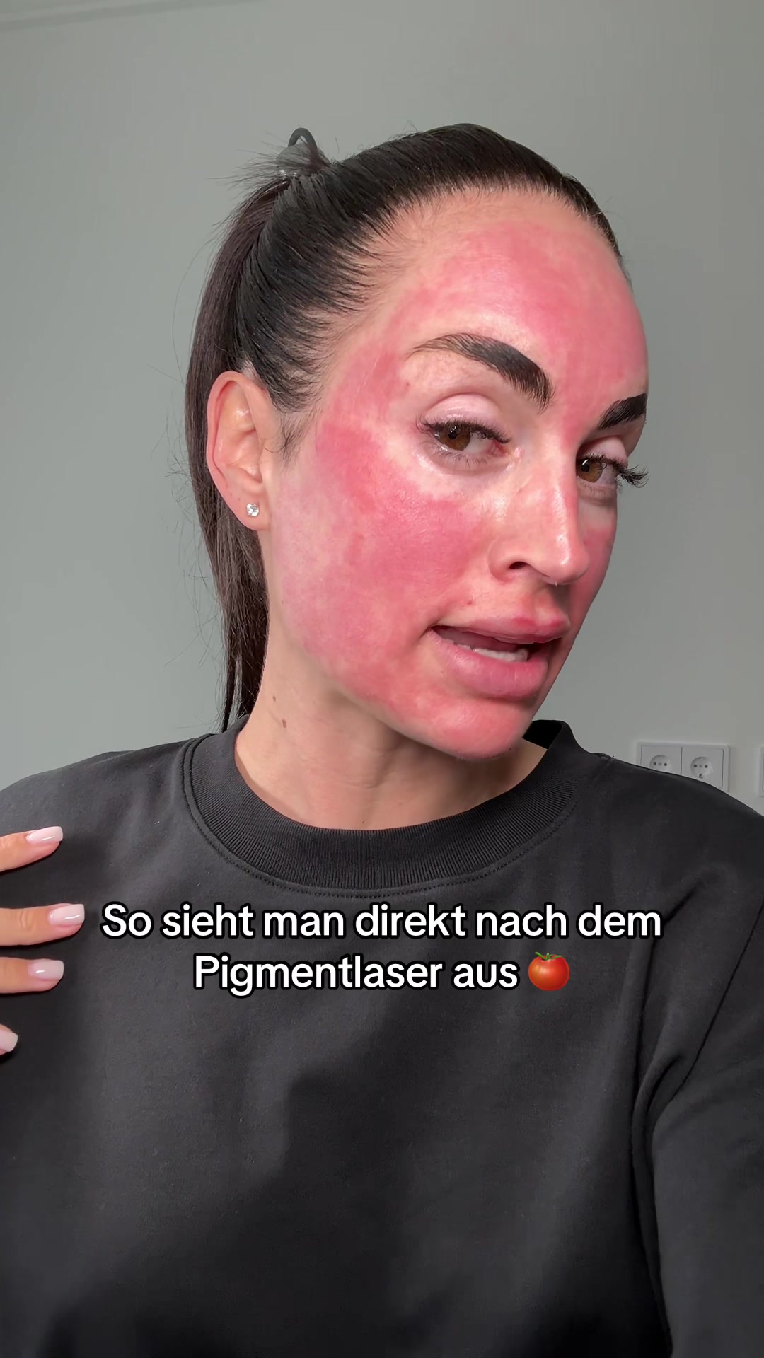 @Melissa | BEAUTYEXPERT