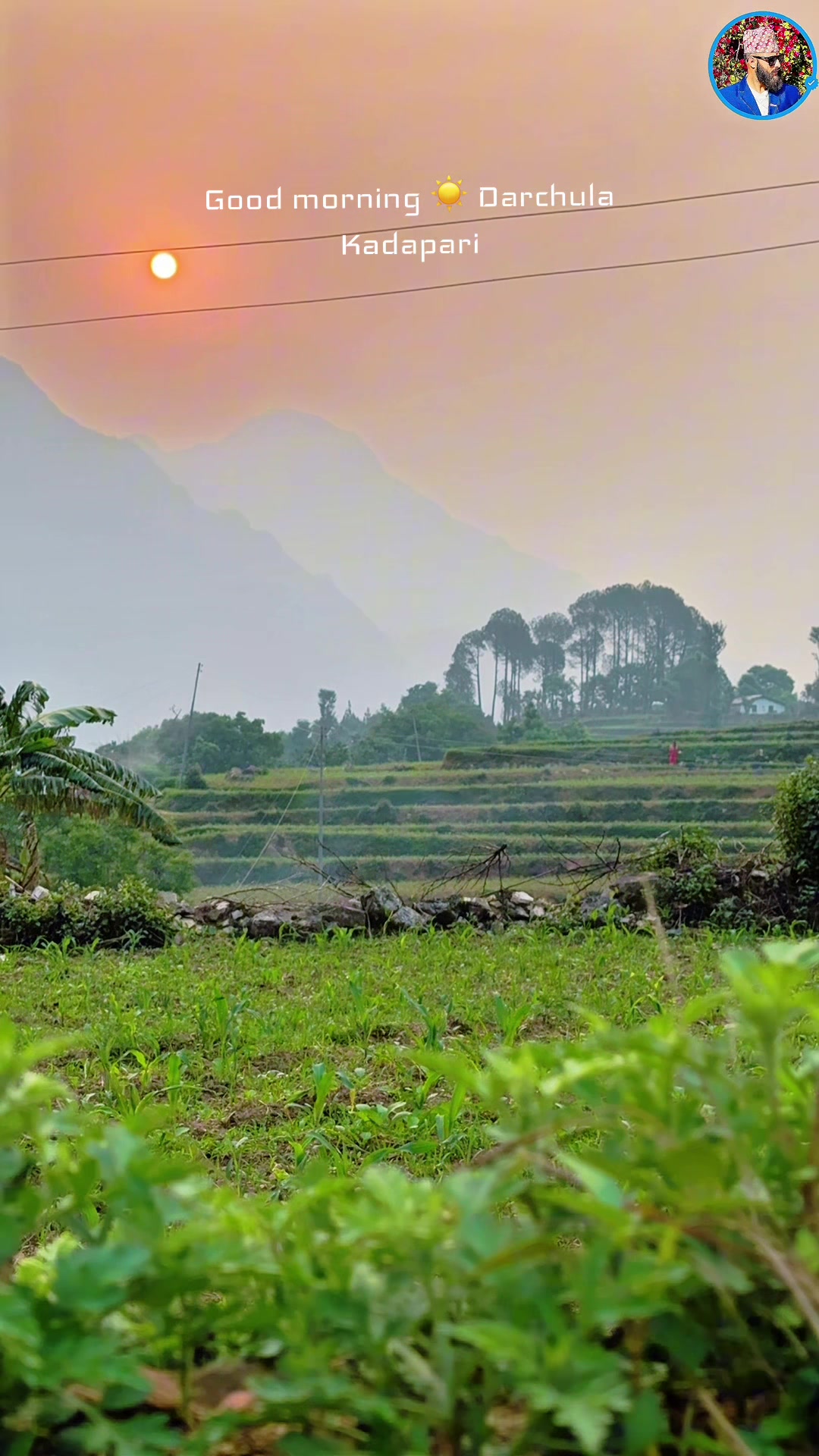 @DP BHATTA ( दारी दाइ )